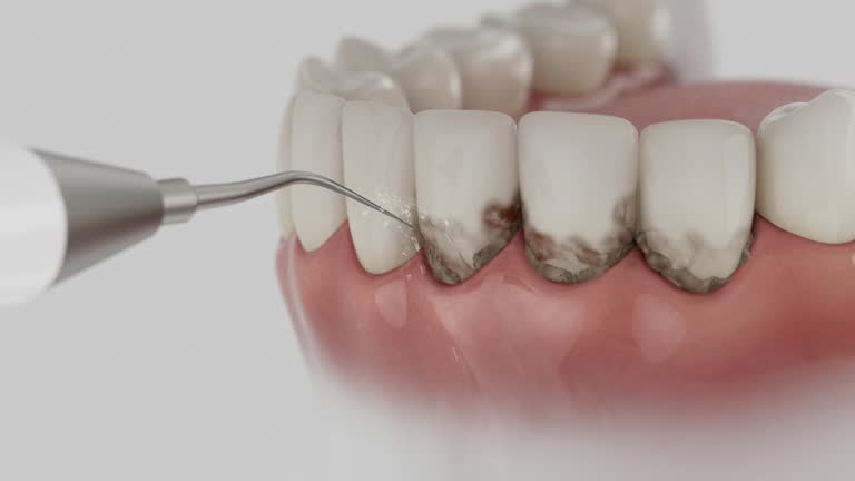 Reliable Emergency Dentist contractor in Wallace, ID by Smile Center Dentistry
